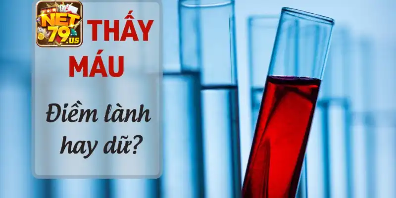 Mơ Thấy Máu: Giải Mã Điềm Báo Giúp Bạn Chiến Thắng Tại Net79 3 Điềm báo ẩn chứa phía sau giấc mơ