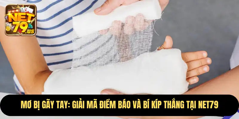 Mơ Bị Gãy Tay: Giải Mã Điềm Báo Và Bí Kíp Thắng Tại Net79 3 Mơ Bị Gãy Tay