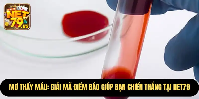 Mơ Thấy Máu: Giải Mã Điềm Báo Giúp Bạn Chiến Thắng Tại Net79 1 Mơ Thấy Máu